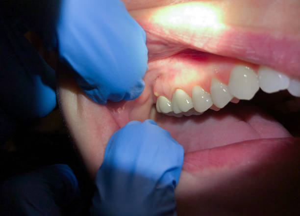 Best Emergency Treatment for Toothache in Potomac Heights, MD