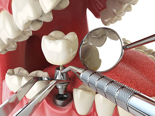 Best Walk-In Emergency Dentist in Potomac Heights, MD