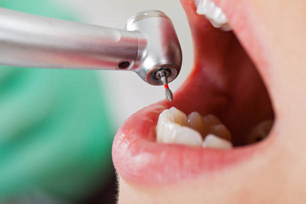 Best After-Hours Emergency Dentist in Potomac Heights, MD